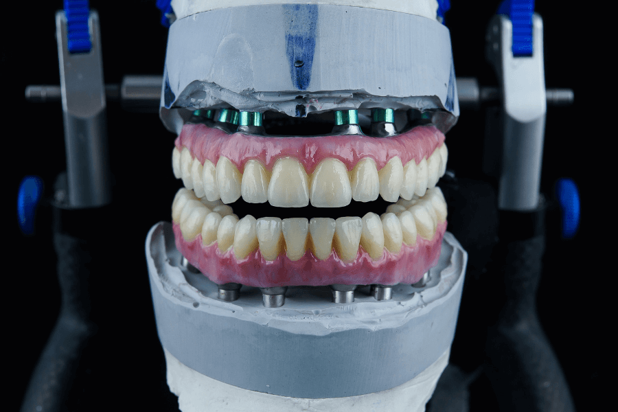 Dentista segurando uma prótese dentária