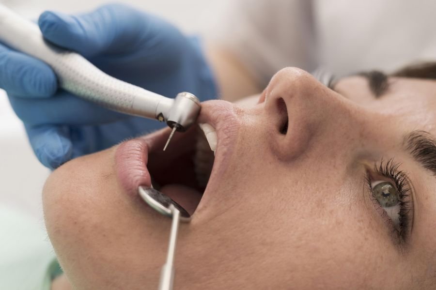 Foto de uma mulher em um atendimento de tártaro