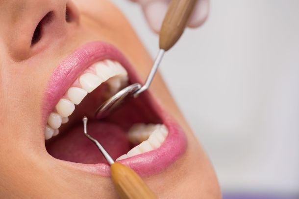 Foto de uma mulher em um atendimento de periotodontia